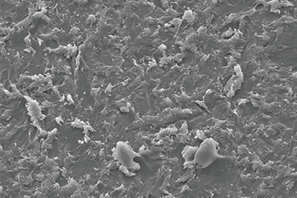topic_sandblast_2_1.jpg